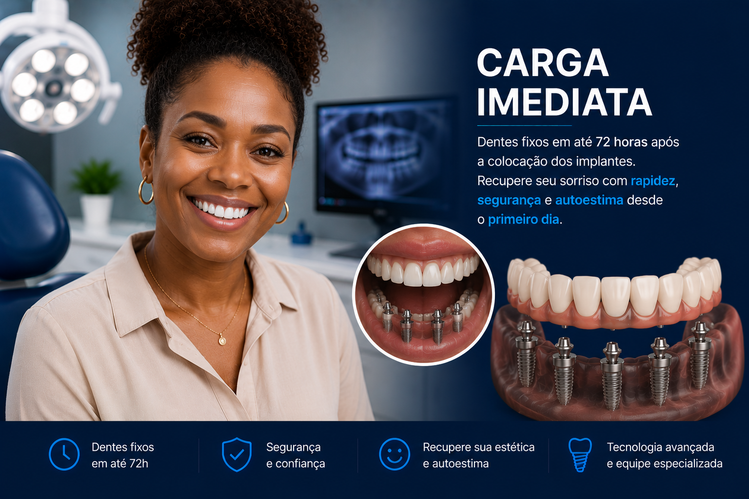Prótese sobre Implante