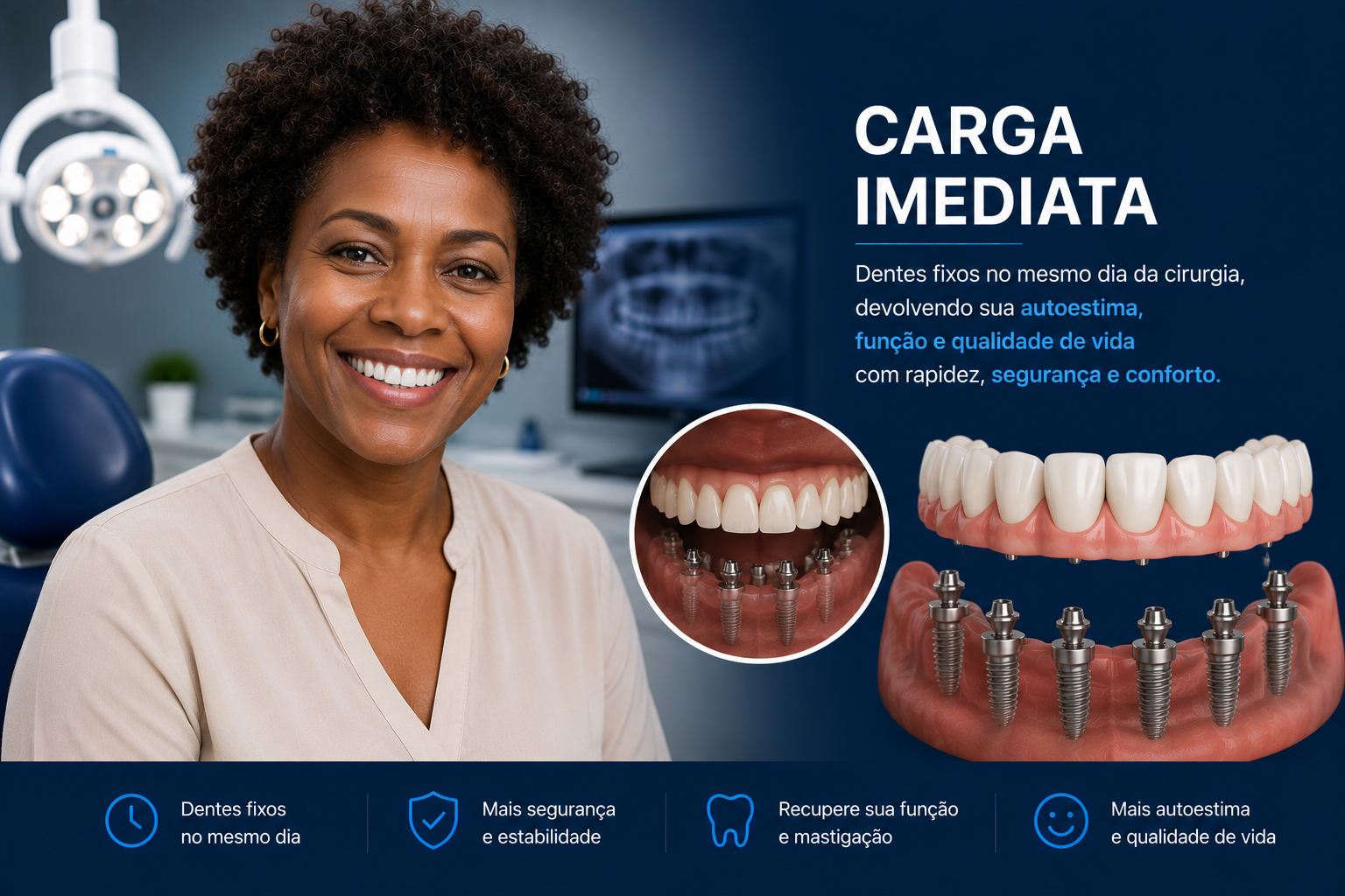 Implantes Dentários