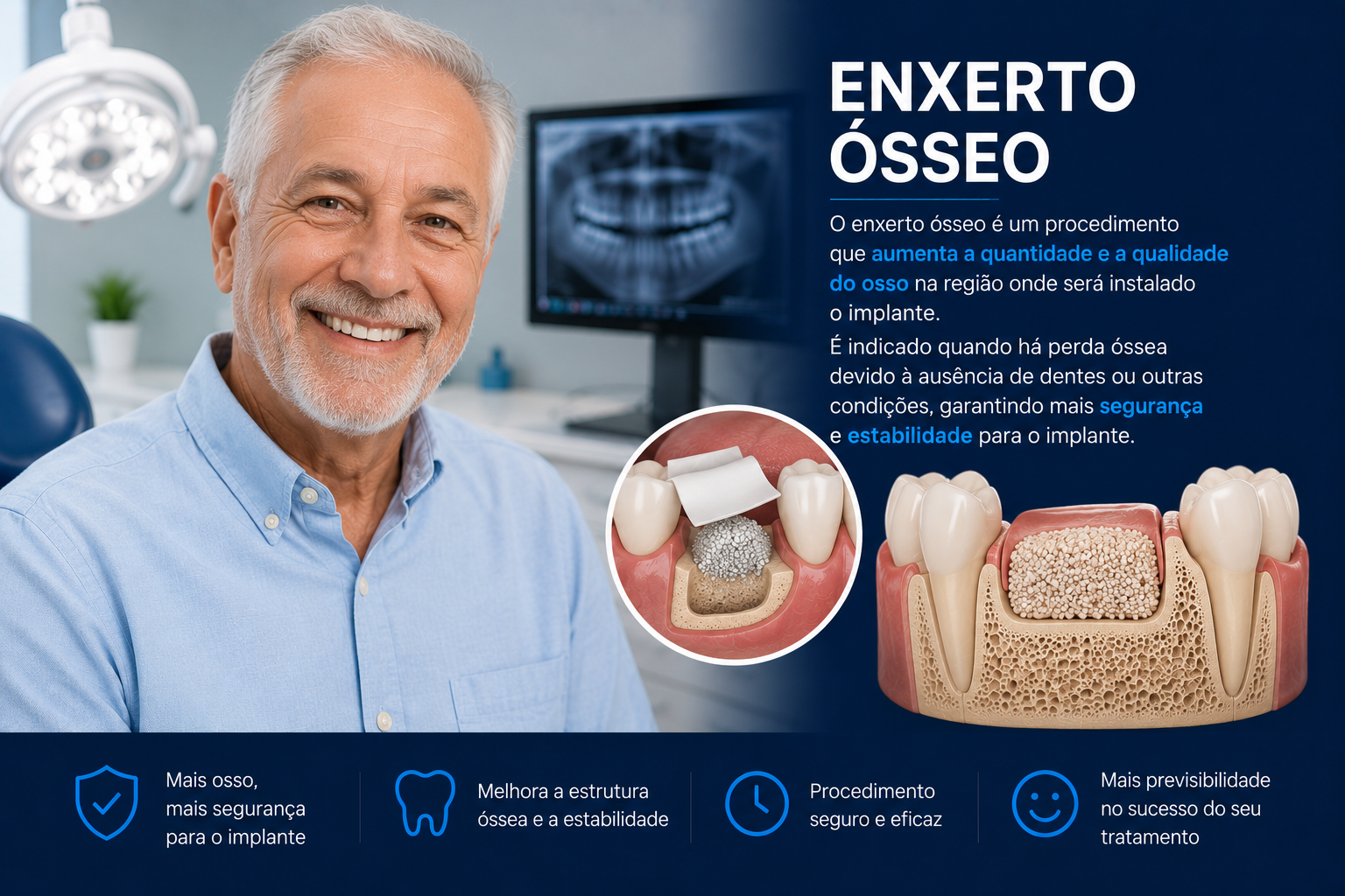 Implante dentário unitário