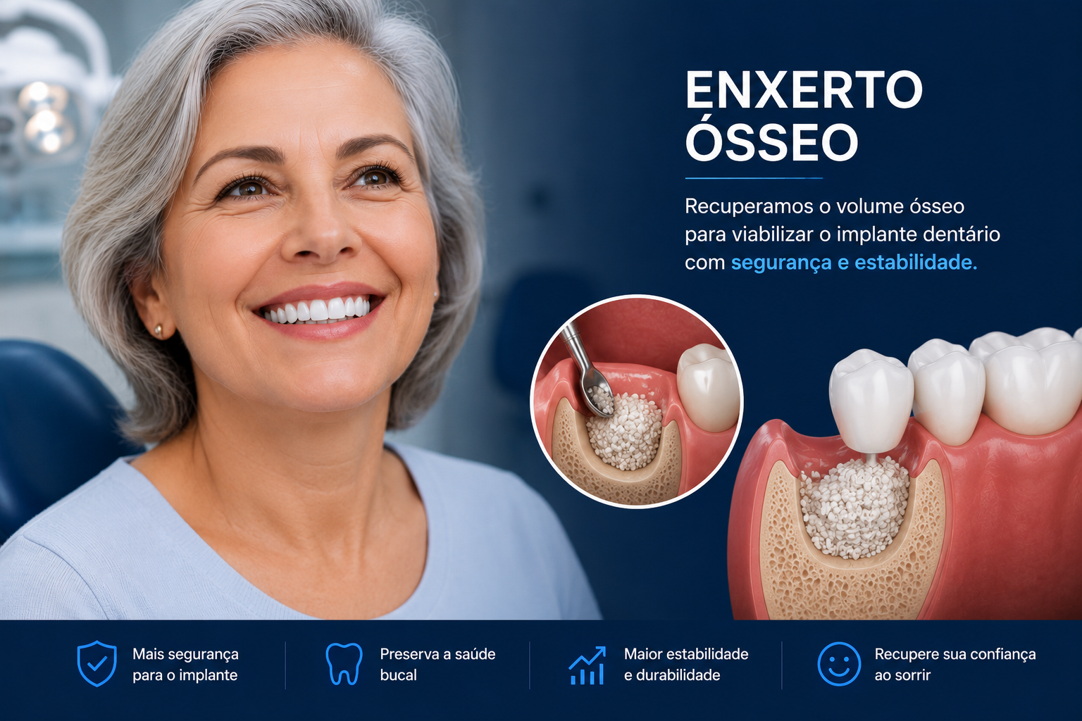 Implantes Dentários