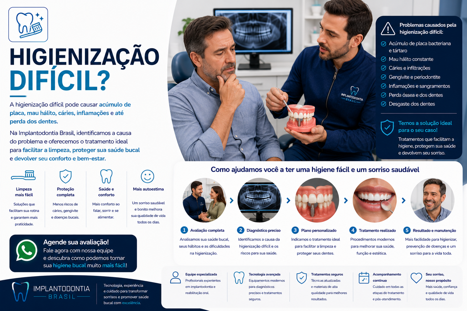Prótese sobre Implante