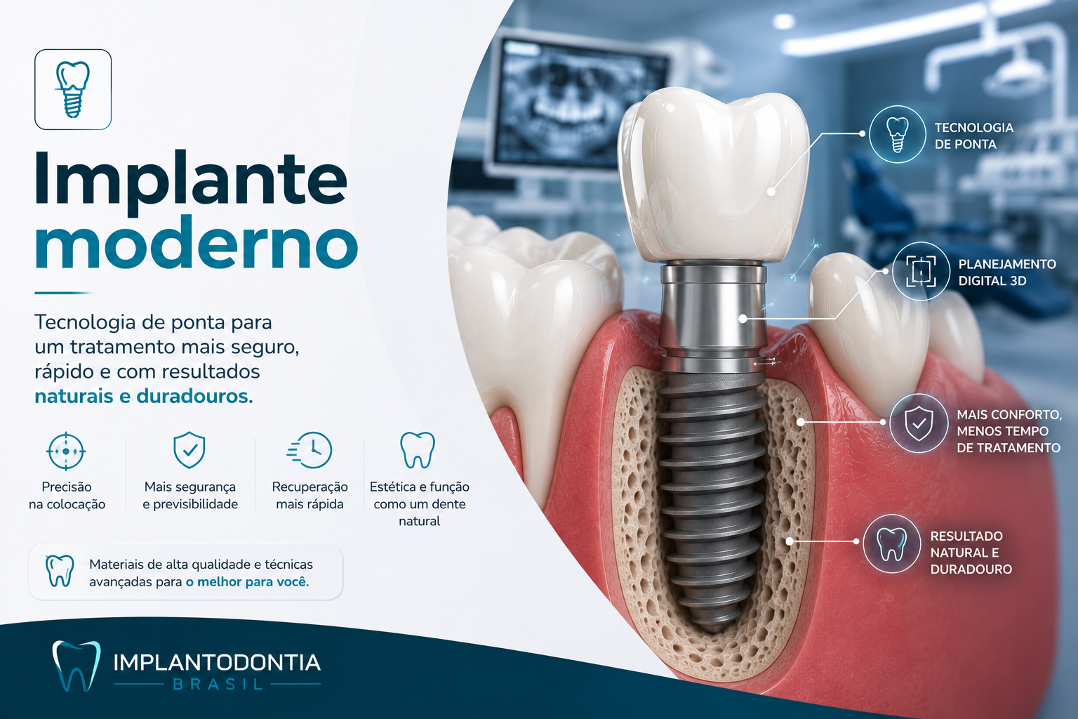 Implantes Dentários