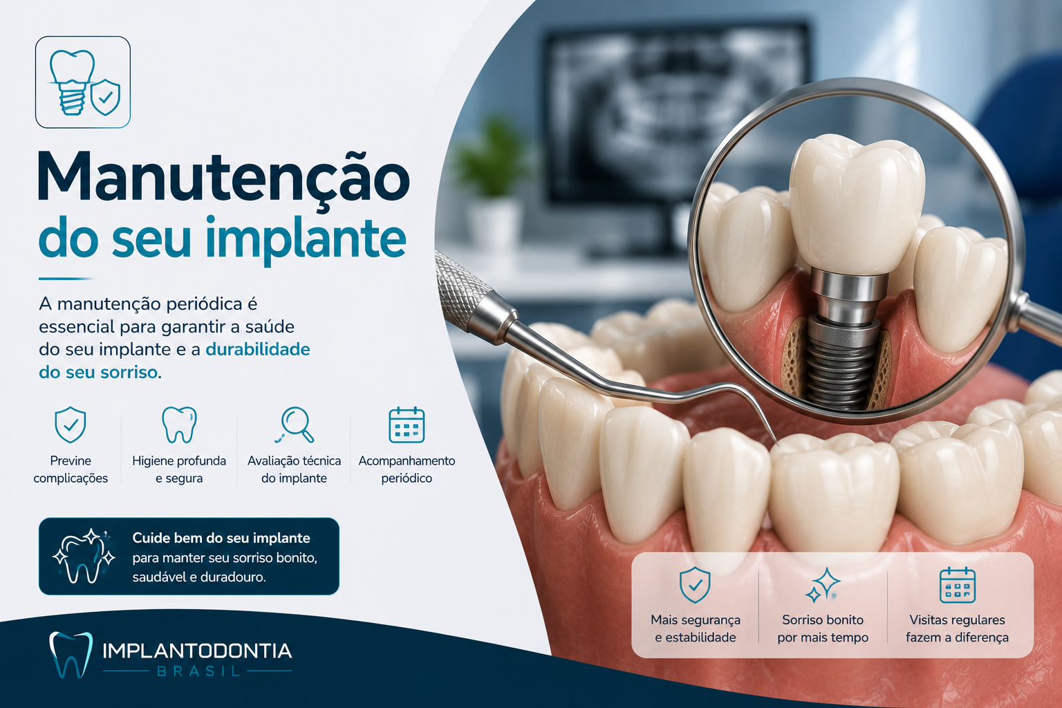 Implantes Dentários