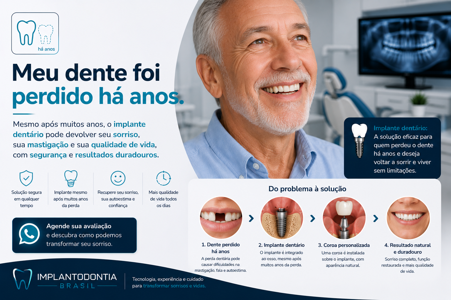 Implante dentário unitário