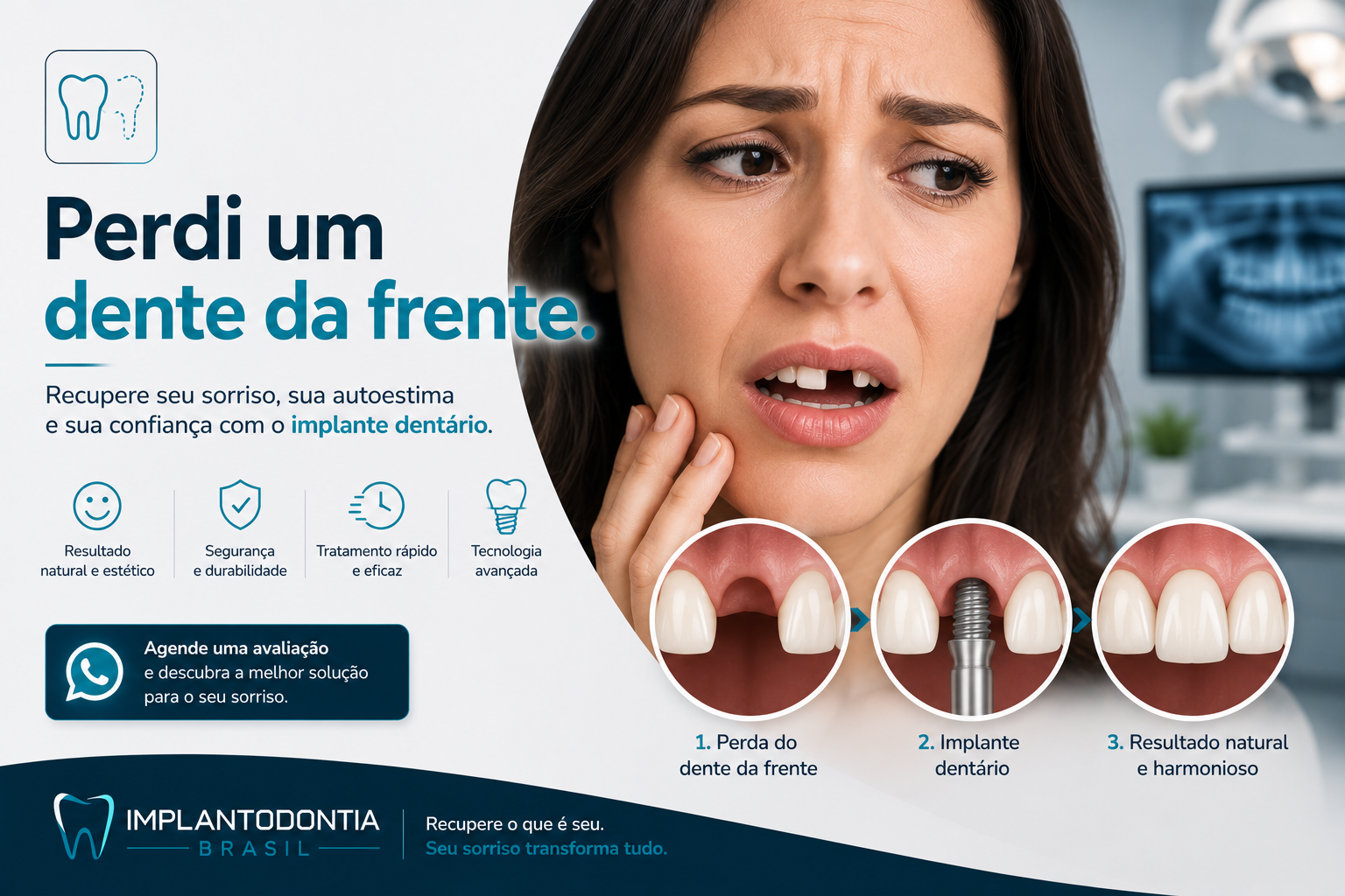 Implante dentário unitário
