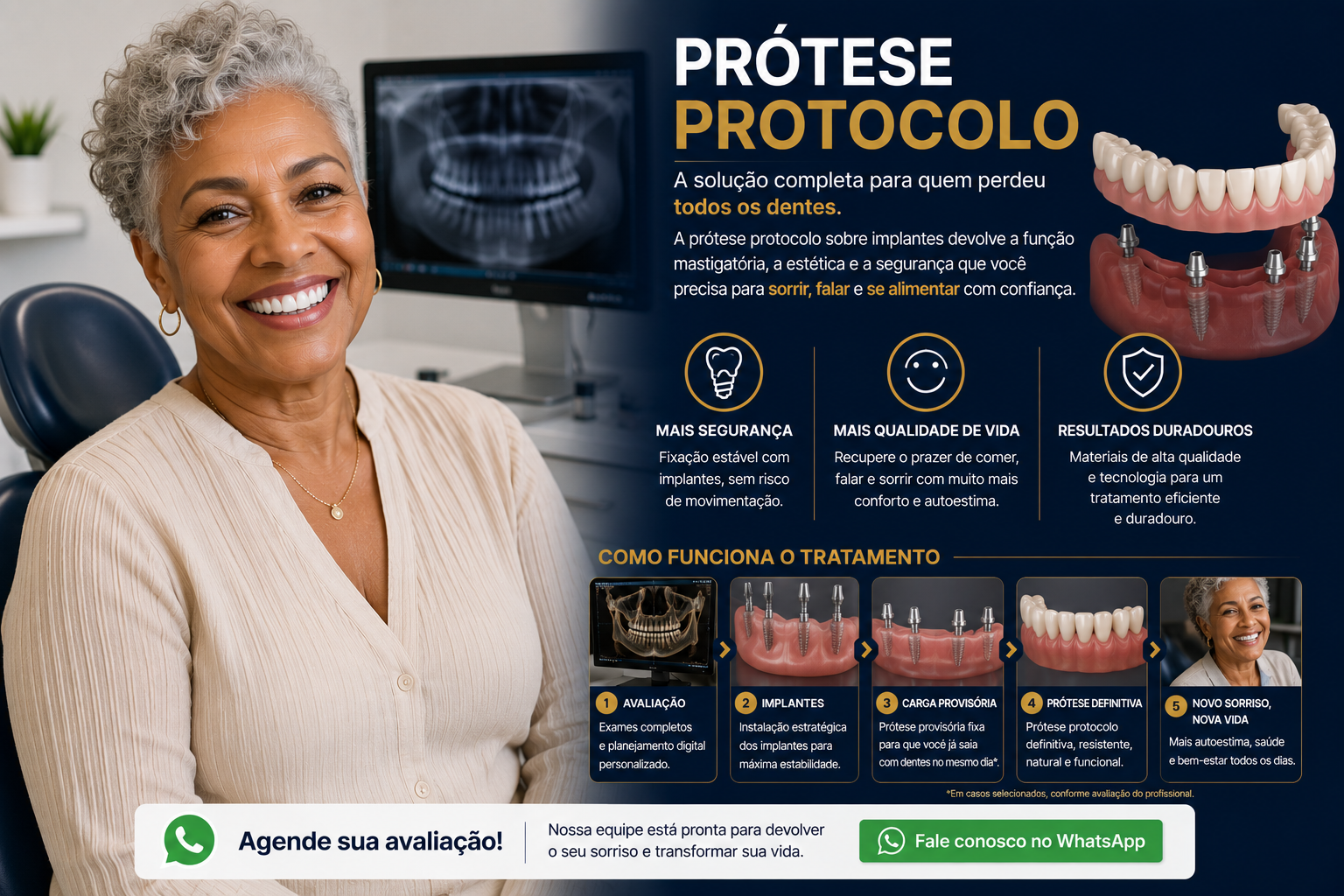 Prótese Protocolo