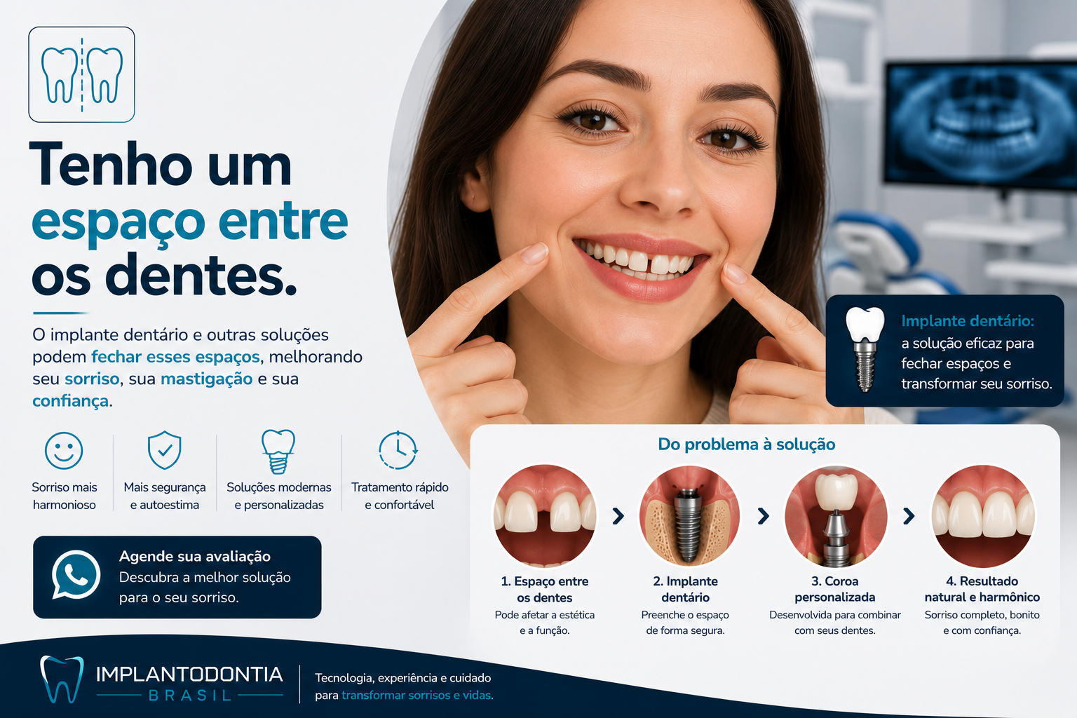 Implante dentário unitário