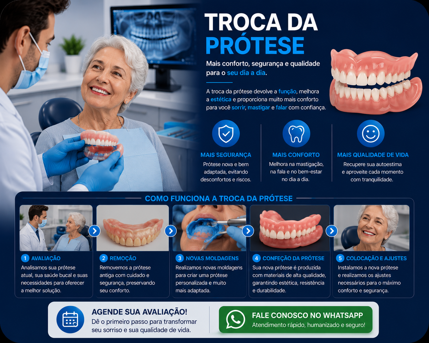 Prótese sobre Implante