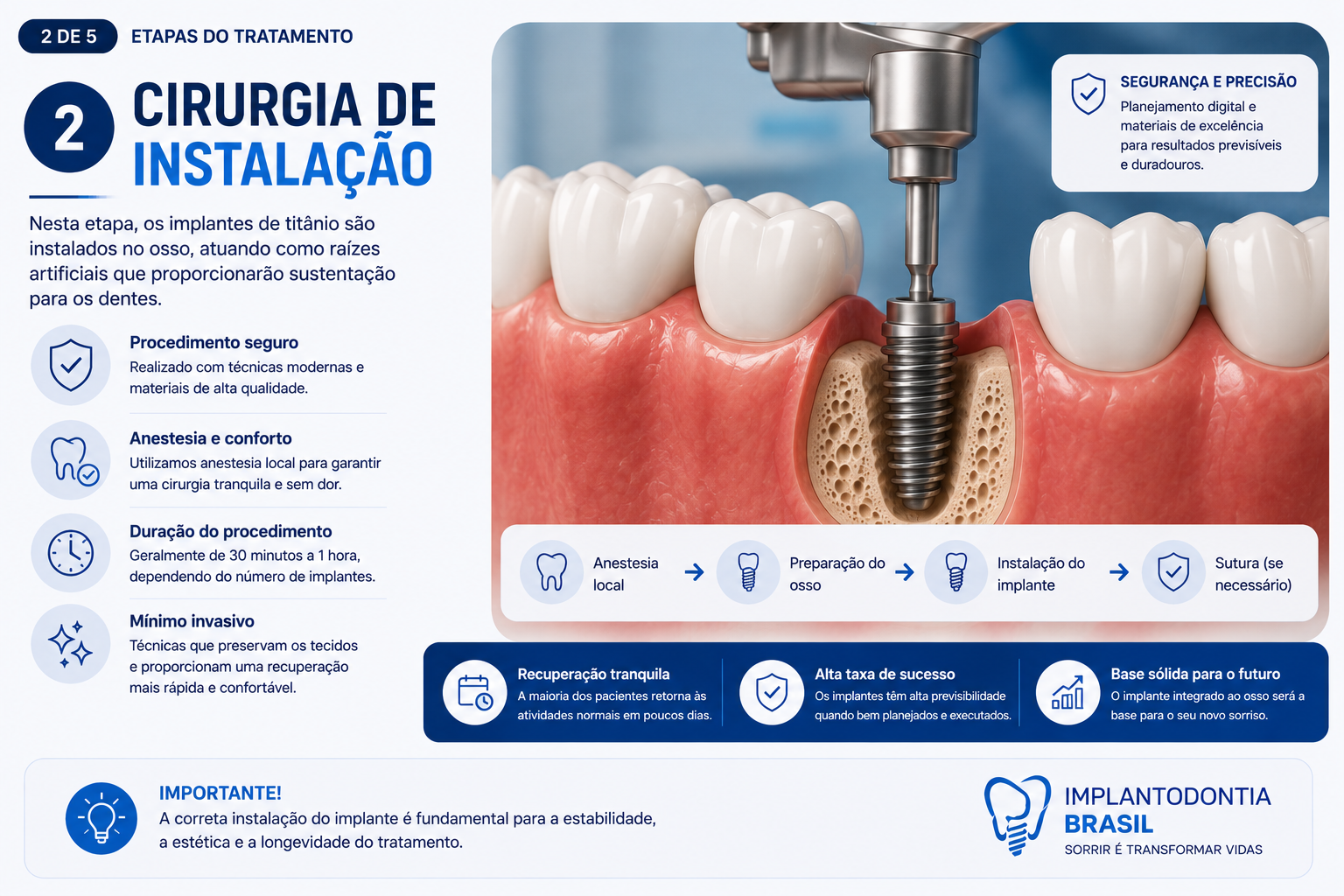Etapa cirúrgica de instalação do implante dentário no osso