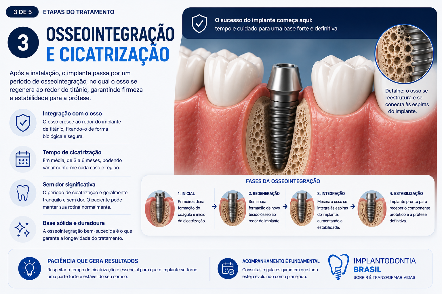 Processo de osseointegração e cicatrização ao redor do implante dentário